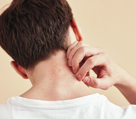 What you should do if you have a rash